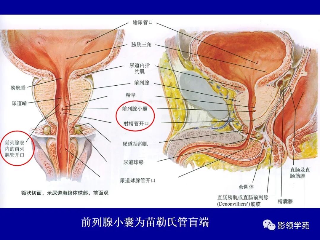 影像PPT - 【PPT】前列腺癌MRI诊断再认识-30