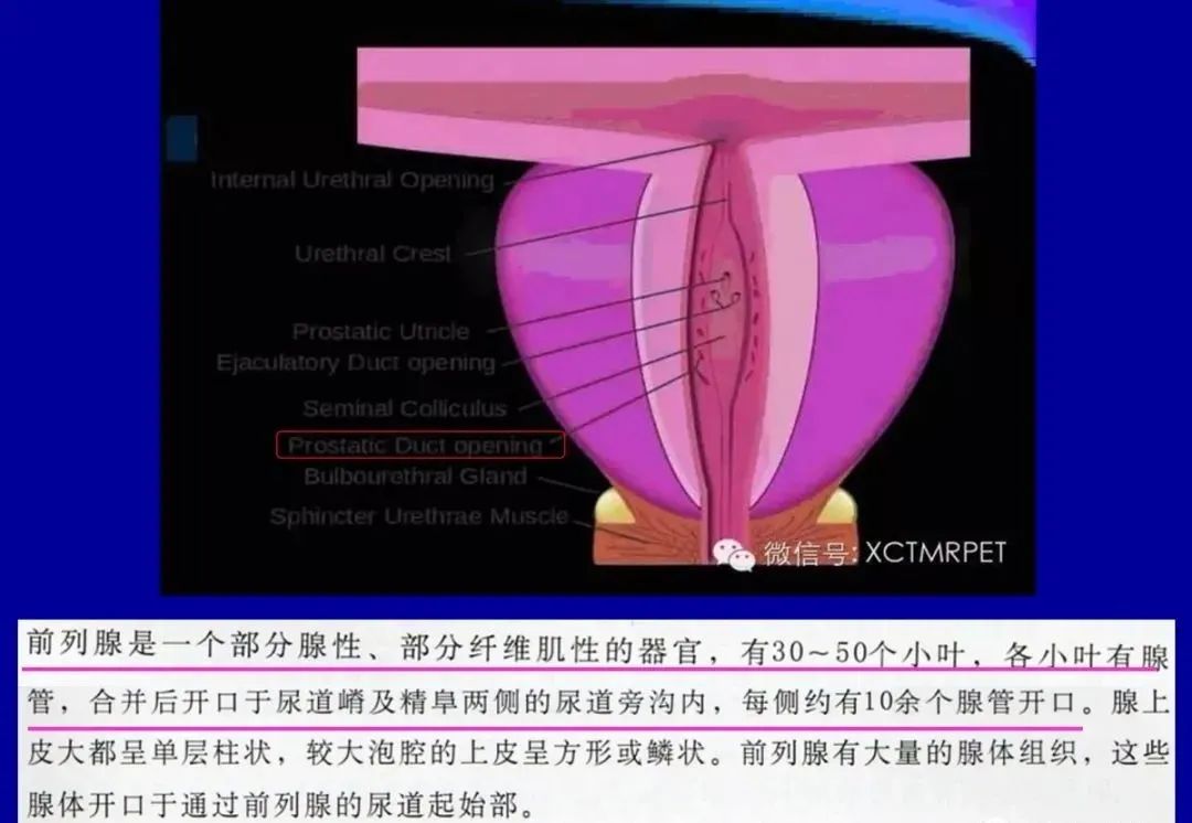 影像PPT - 【PPT】前列腺癌MRI诊断再认识-31