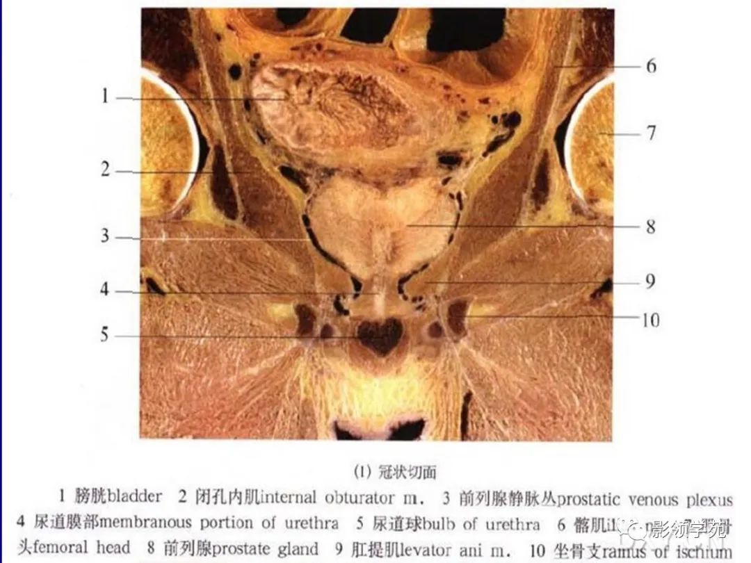 影像PPT - 【PPT】前列腺癌MRI诊断再认识-33
