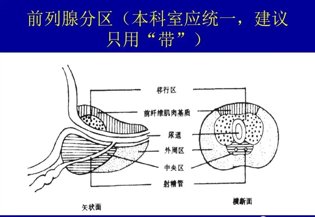 影像PPT - 【PPT】前列腺癌MRI诊断再认识-40