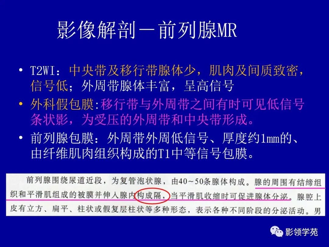 影像PPT - 【PPT】前列腺癌MRI诊断再认识-44