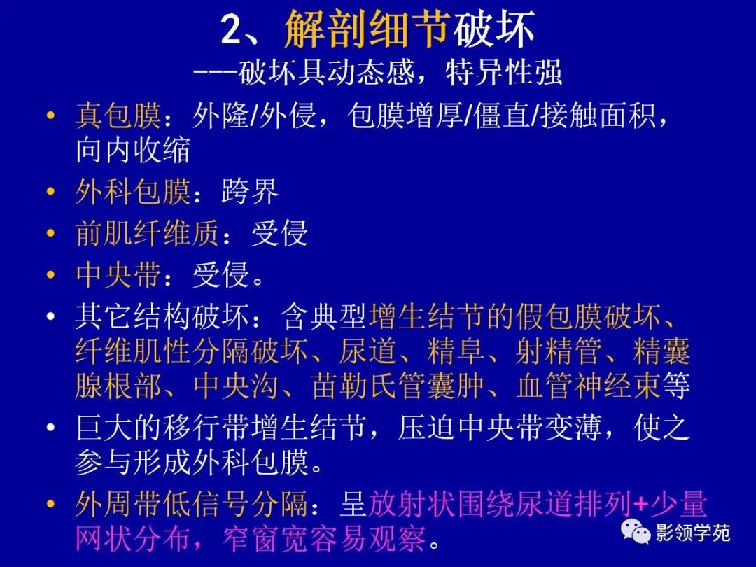 影像PPT - 【PPT】前列腺癌MRI诊断再认识-79