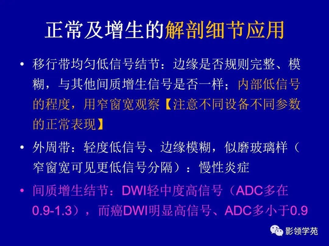 影像PPT - 【PPT】前列腺癌MRI诊断再认识-82