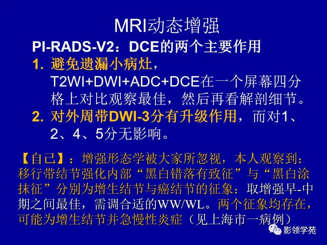 影像PPT - 【PPT】前列腺癌MRI诊断再认识-109