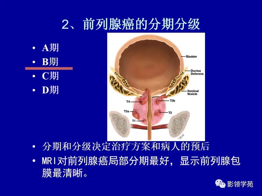 影像PPT - 【PPT】前列腺癌MRI诊断再认识-118