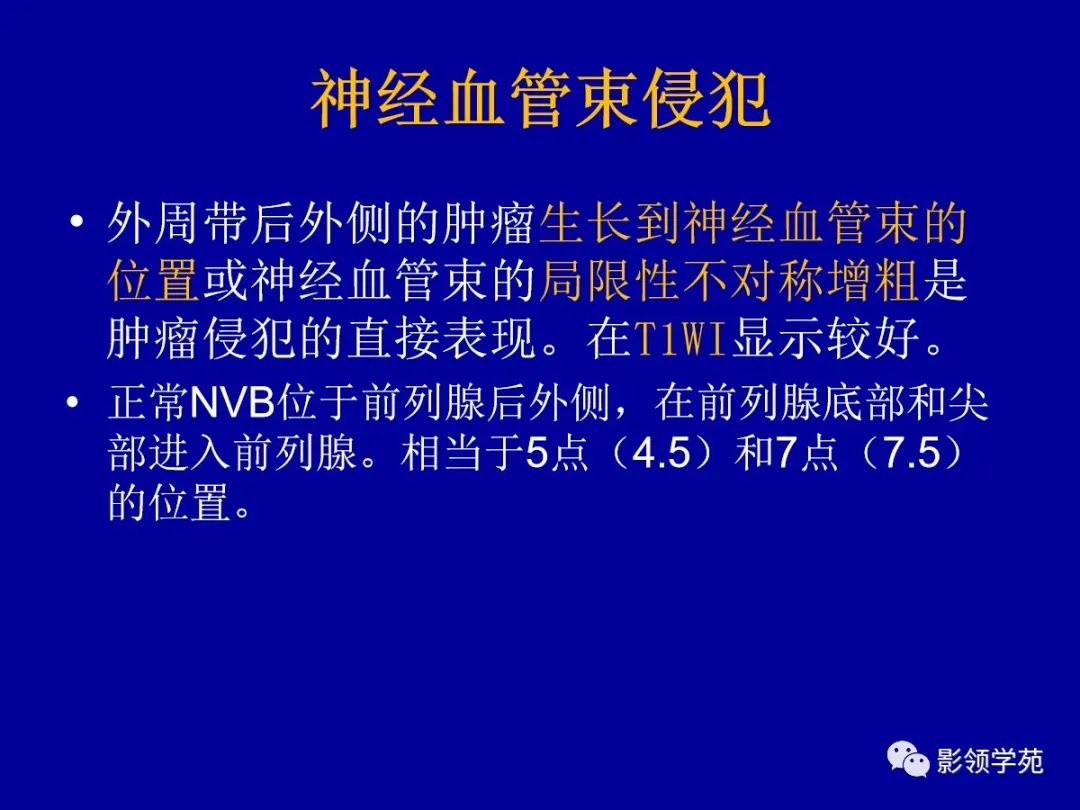 影像PPT - 【PPT】前列腺癌MRI诊断再认识-124