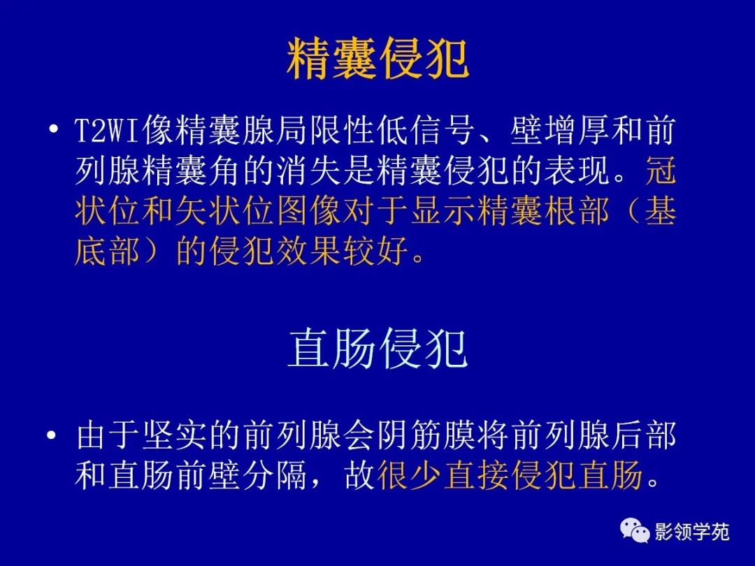影像PPT - 【PPT】前列腺癌MRI诊断再认识-129