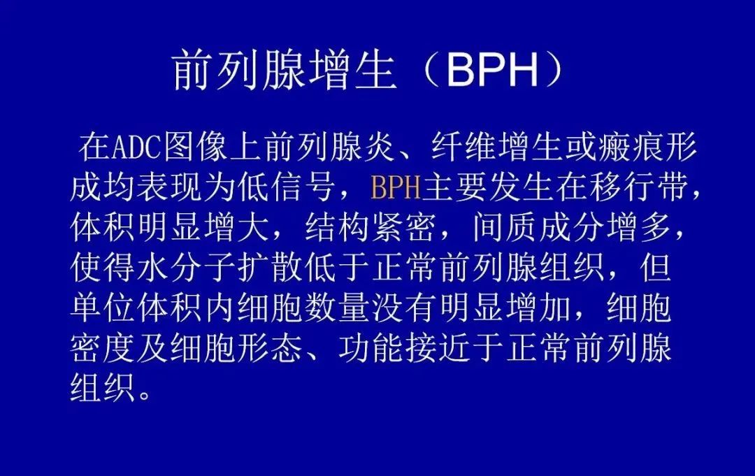 影像PPT - 【PPT】前列腺癌MRI诊断再认识-144