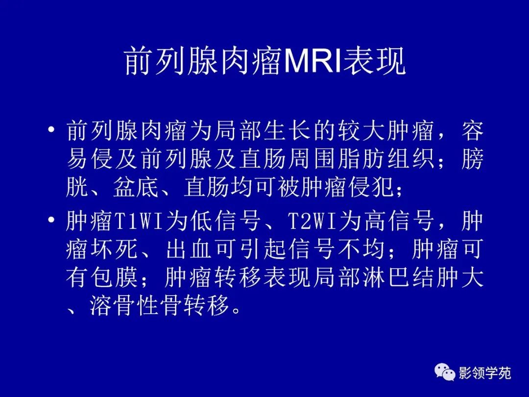 影像PPT - 【PPT】前列腺癌MRI诊断再认识-153