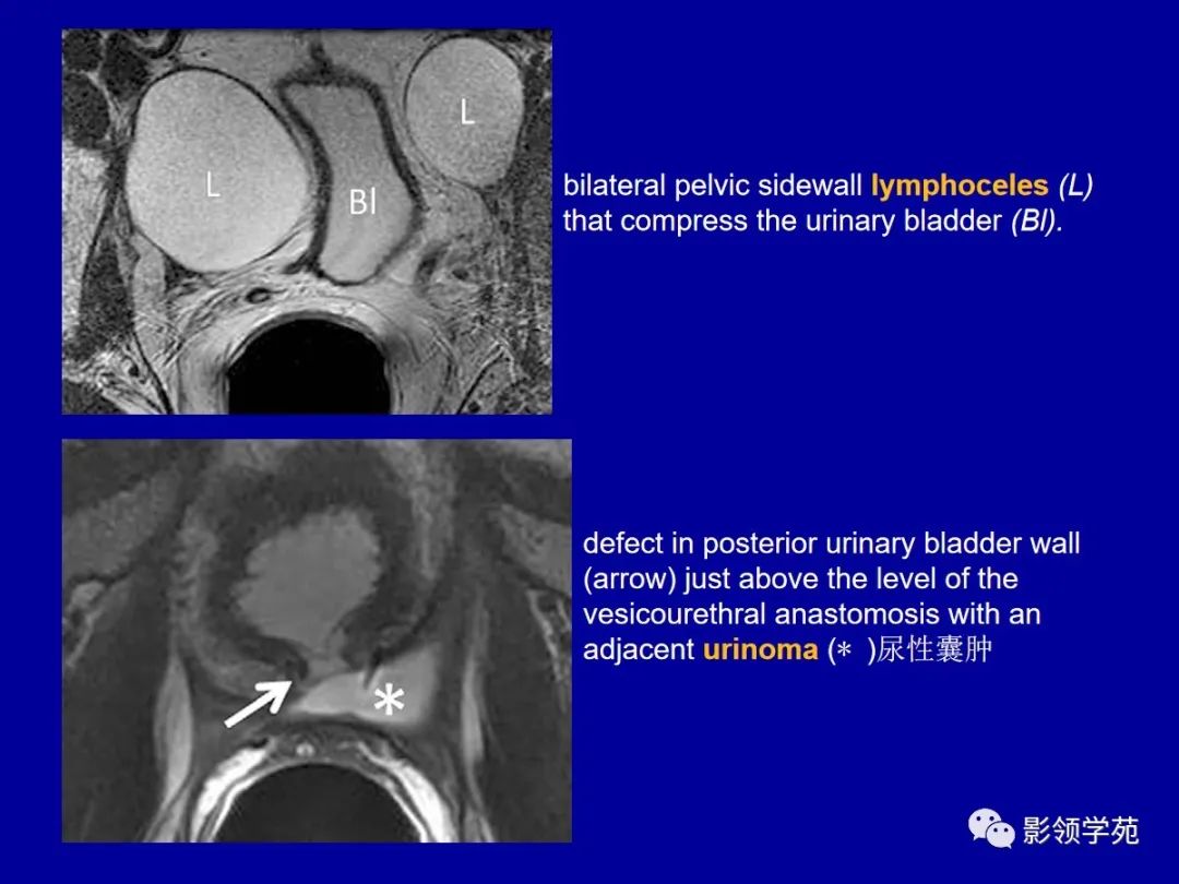 影像PPT - 【PPT】前列腺癌MRI诊断再认识-165
