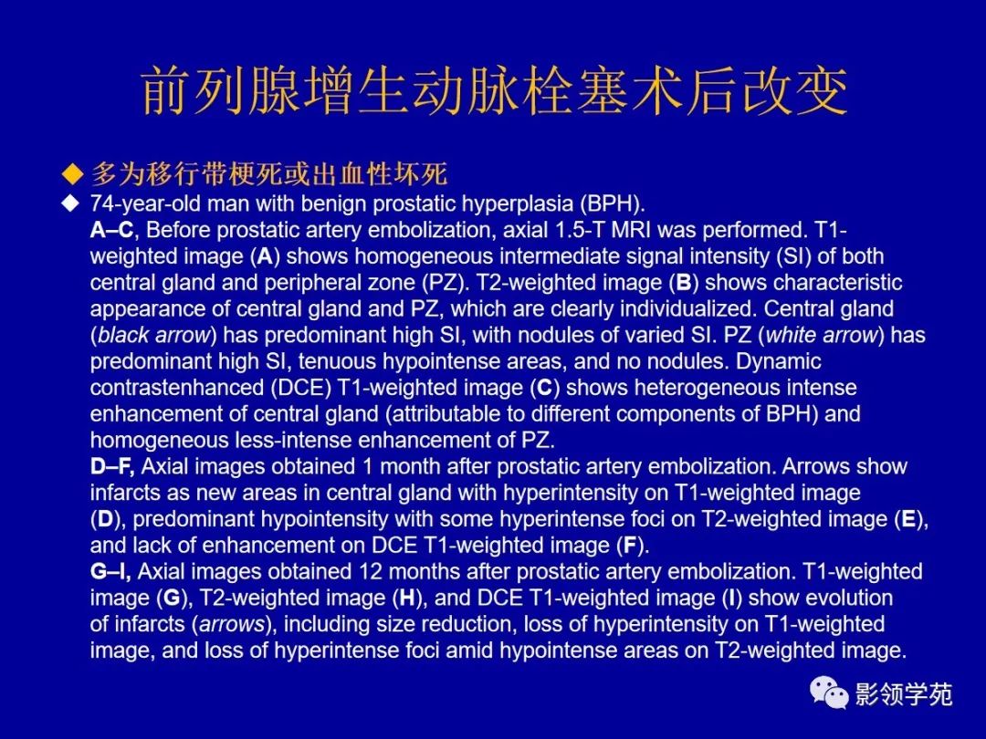 影像PPT - 【PPT】前列腺癌MRI诊断再认识-170