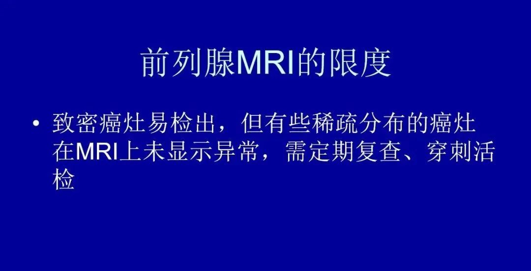 影像PPT - 【PPT】前列腺癌MRI诊断再认识-173