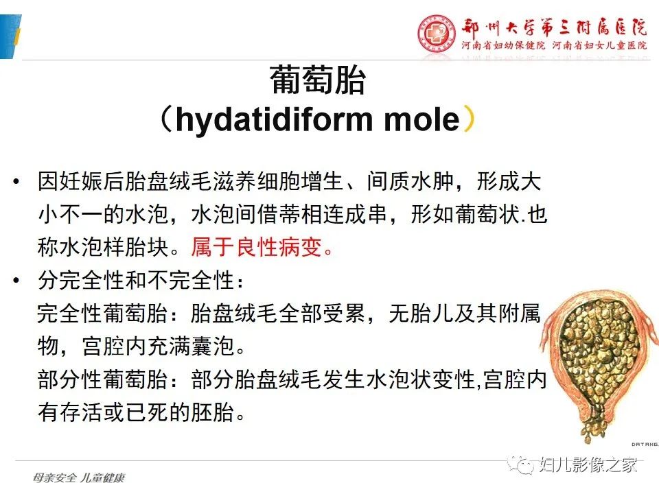 影像PPT - 【PPT】滋养细胞疾病CT/MR诊断-6