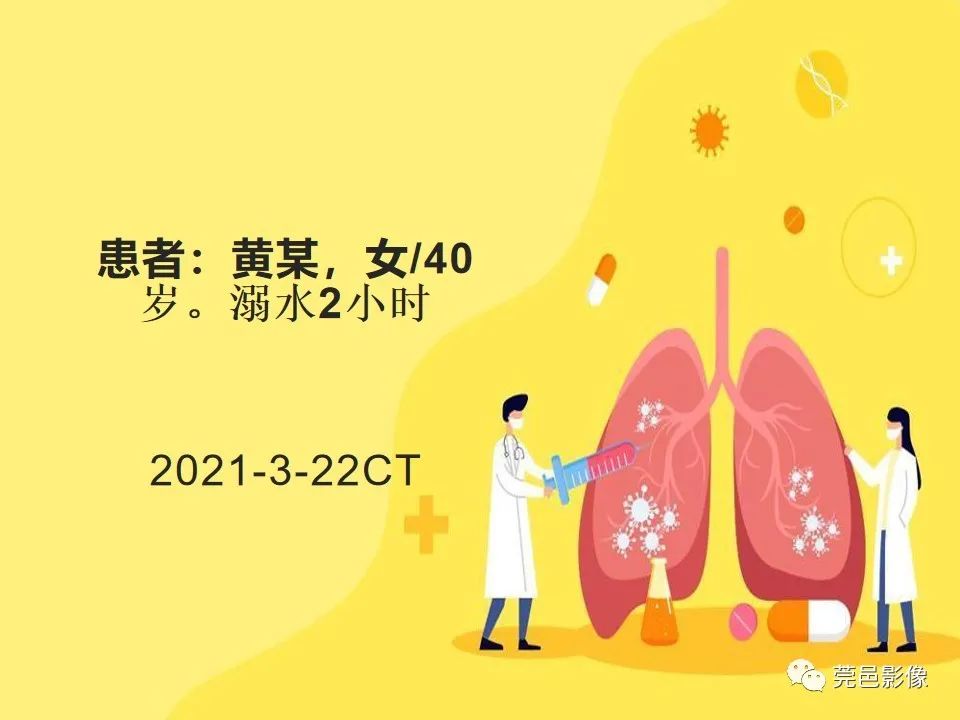 影像PPT - 【PPT】溺水性肺水肿-2