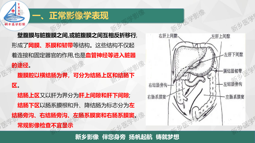 影像PPT - 【PPT】腹膜解剖及腹膜病变影像表现-1