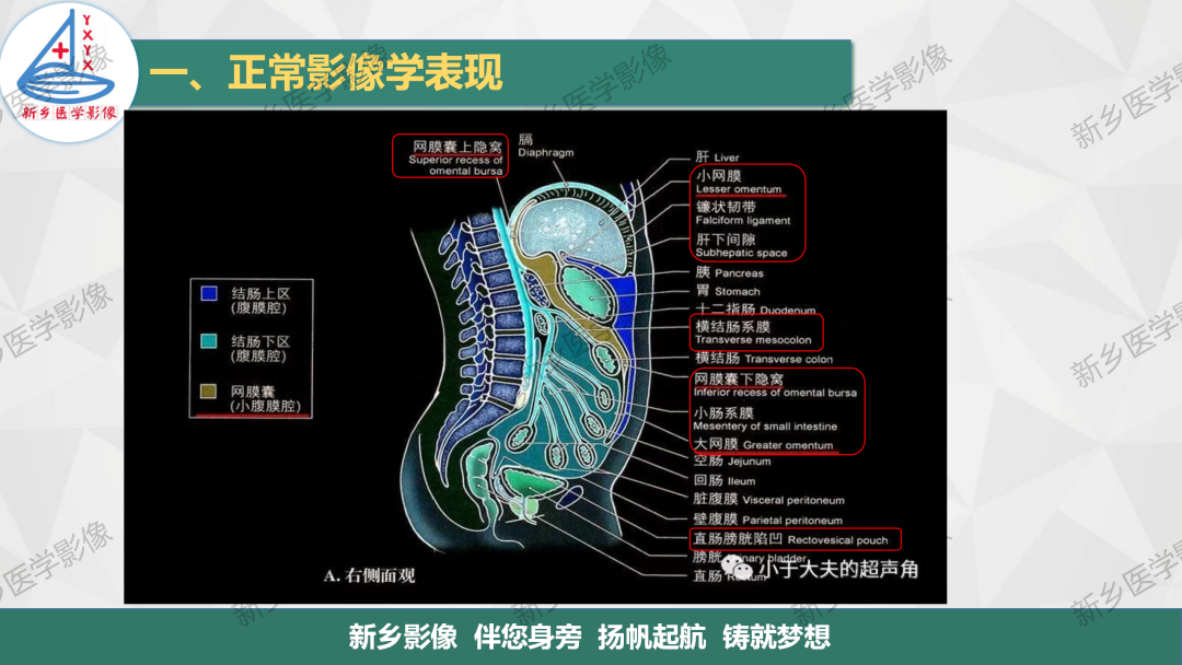 影像PPT - 【PPT】腹膜解剖及腹膜病变影像表现-5