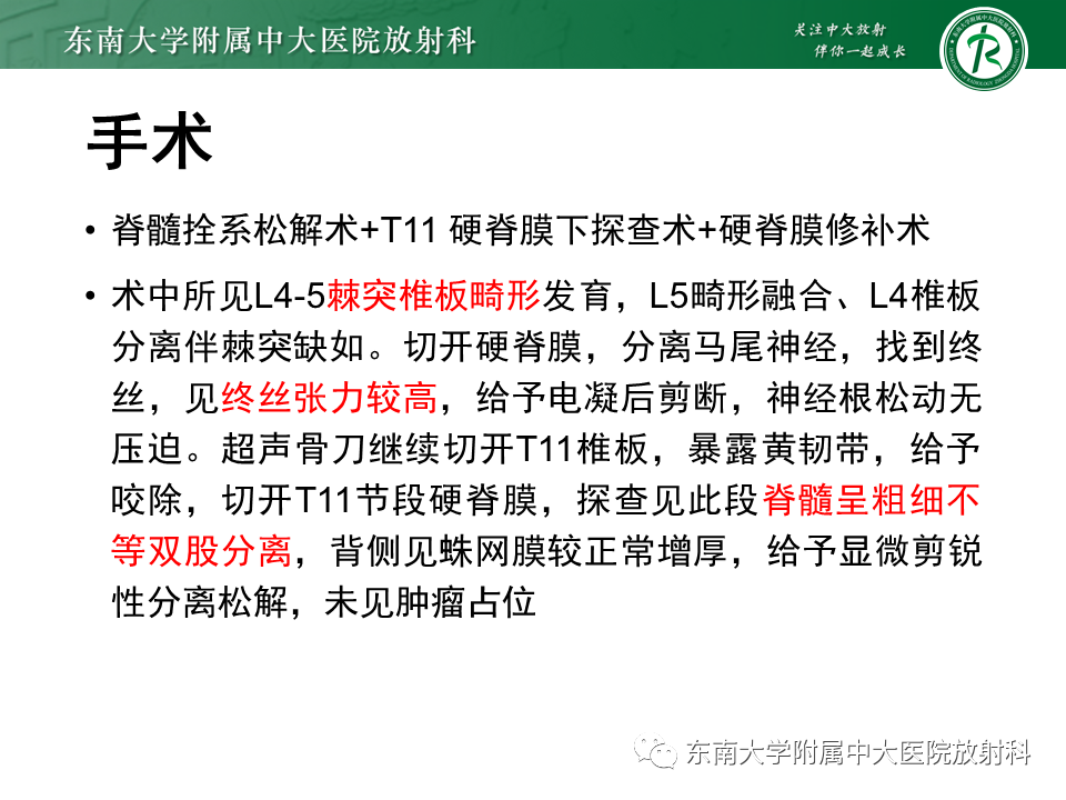 影像PPT - 【PPT】原发性脊髓拴系综合征-5 影像PPT - 【PPT】原发性脊髓拴系综合征-5