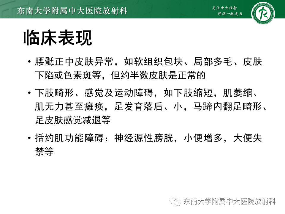 影像PPT - 【PPT】原发性脊髓拴系综合征-13 影像PPT - 【PPT】原发性脊髓拴系综合征-13