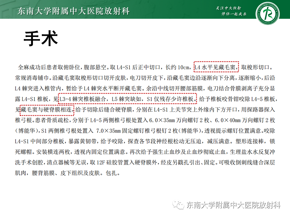 影像PPT - 【PPT】原发性脊髓拴系综合征-20 影像PPT - 【PPT】原发性脊髓拴系综合征-20