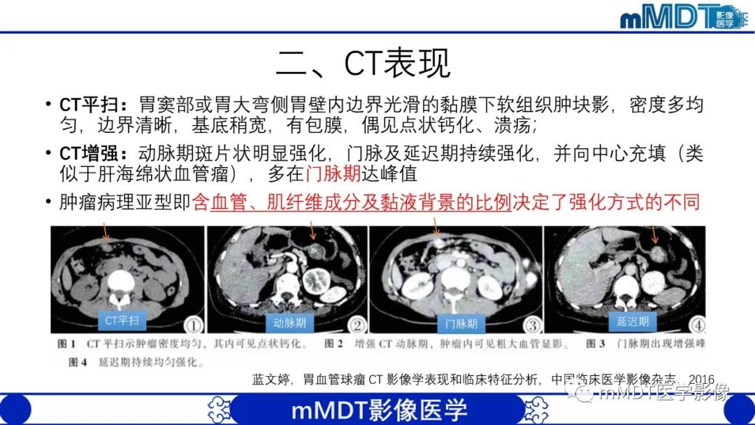 影像PPT - 【PPT】胃血管球瘤的影像诊断-5 影像PPT - 【PPT】胃血管球瘤的影像诊断-5
