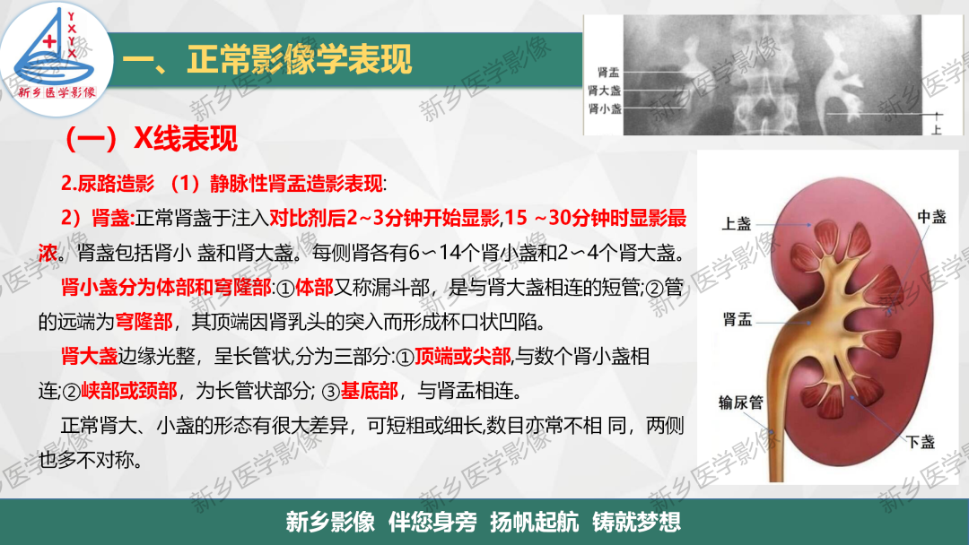 影像PPT - 【PPT】泌尿生殖系统解剖及基本病变影像表现-5