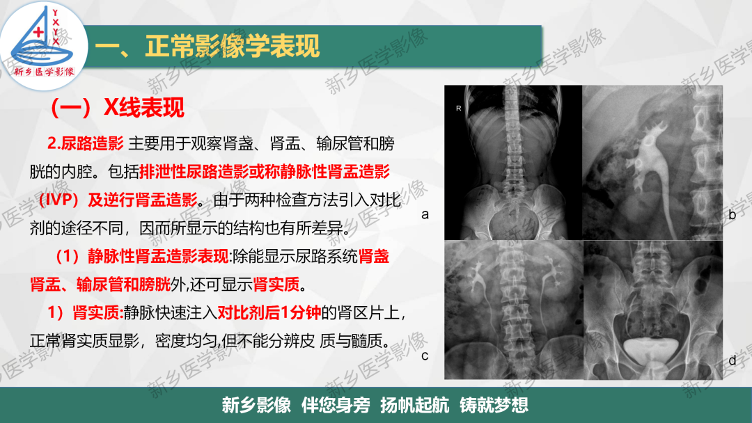 影像PPT - 【PPT】泌尿生殖系统解剖及基本病变影像表现-4