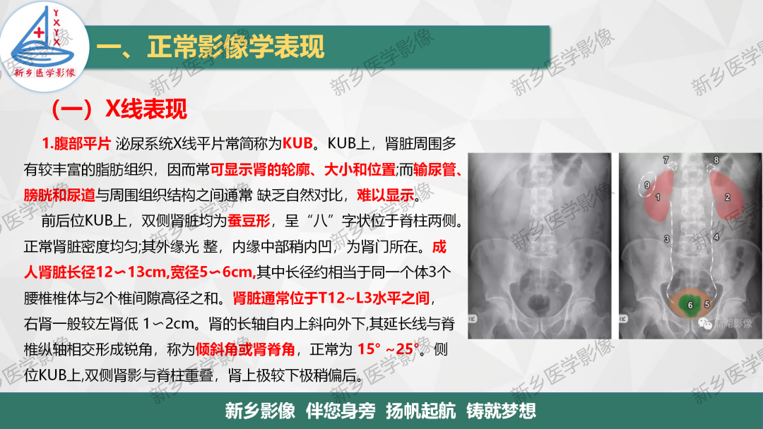 影像PPT - 【PPT】泌尿生殖系统解剖及基本病变影像表现-3