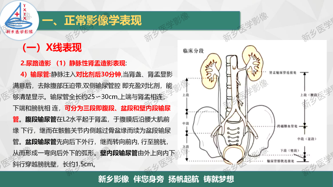 影像PPT - 【PPT】泌尿生殖系统解剖及基本病变影像表现-8