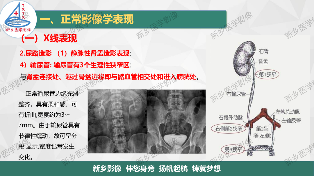 影像PPT - 【PPT】泌尿生殖系统解剖及基本病变影像表现-9