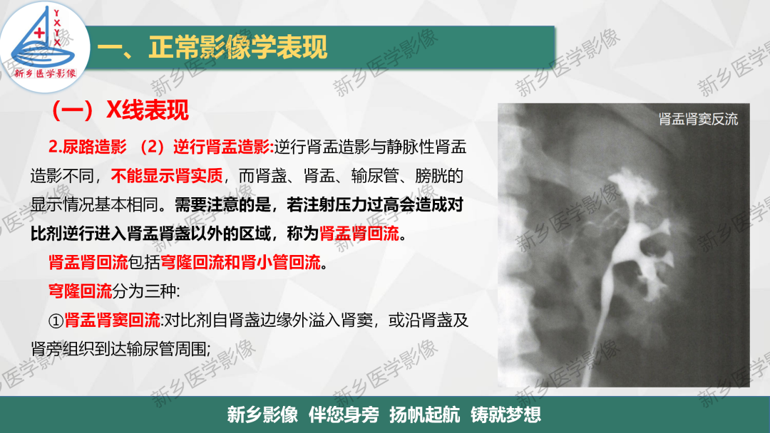 影像PPT - 【PPT】泌尿生殖系统解剖及基本病变影像表现-11