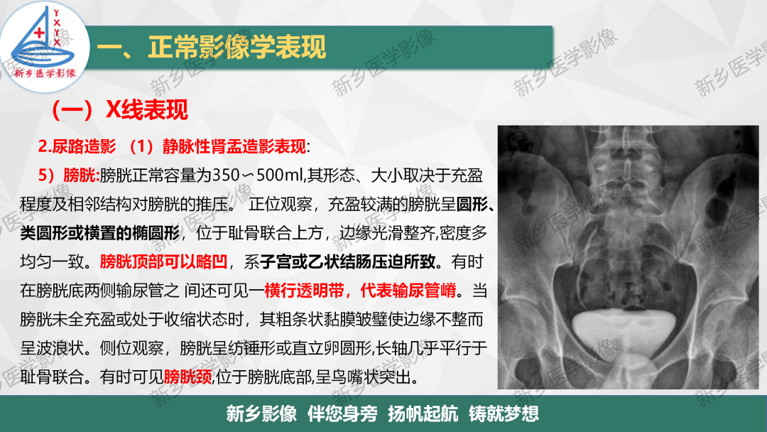 影像PPT - 【PPT】泌尿生殖系统解剖及基本病变影像表现-10