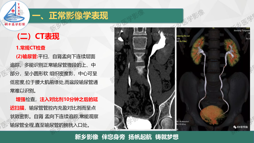 影像PPT - 【PPT】泌尿生殖系统解剖及基本病变影像表现-17
