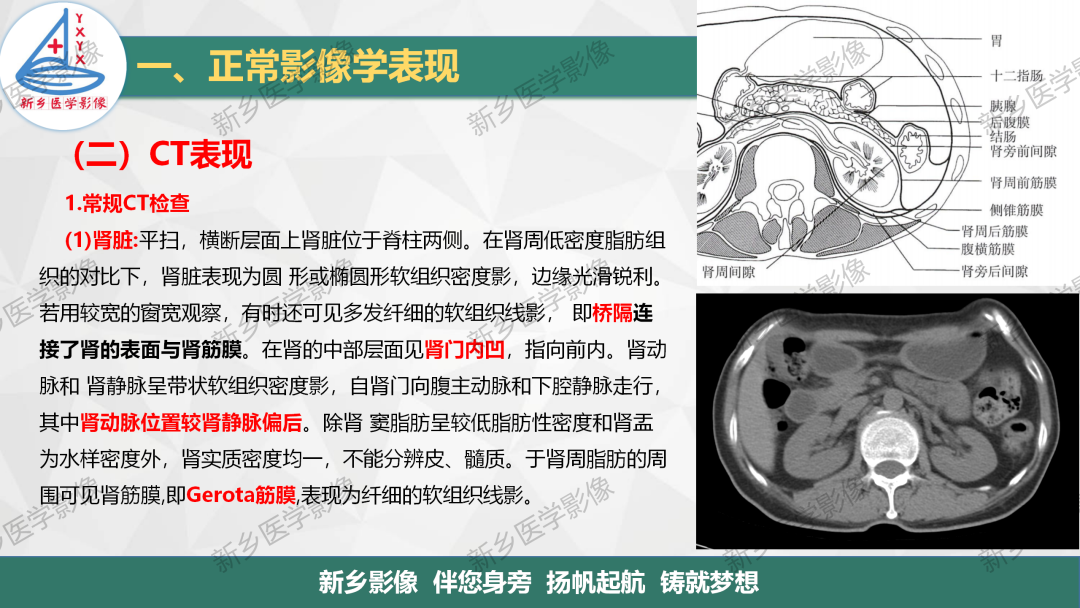 影像PPT - 【PPT】泌尿生殖系统解剖及基本病变影像表现-15