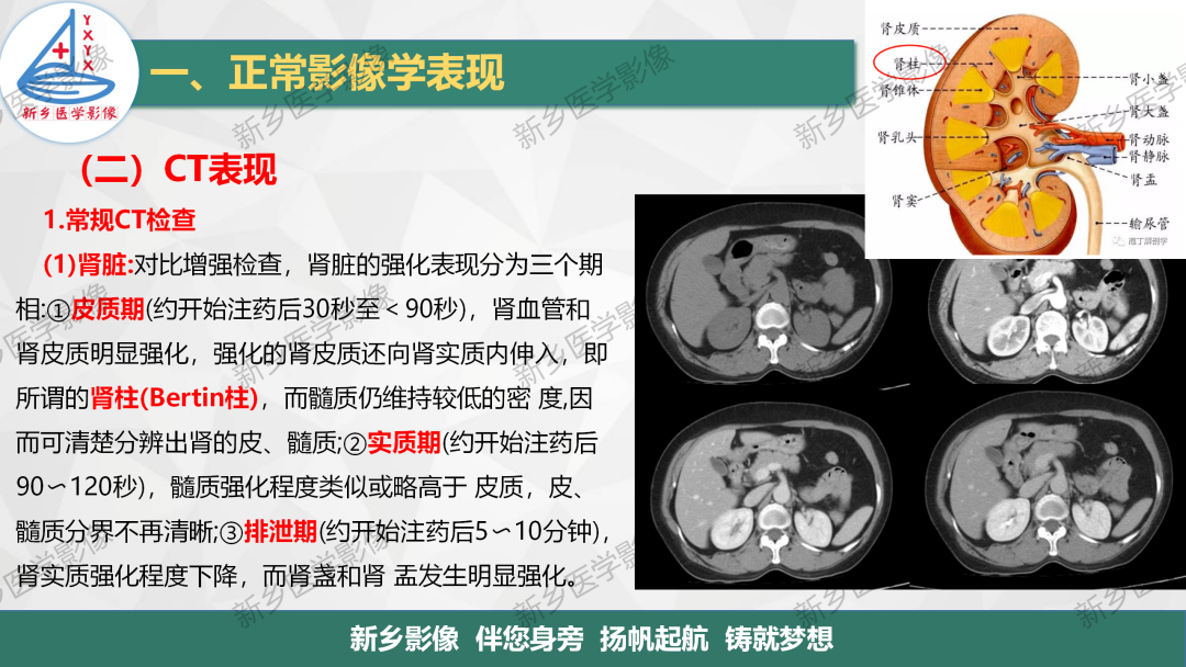 影像PPT - 【PPT】泌尿生殖系统解剖及基本病变影像表现-16