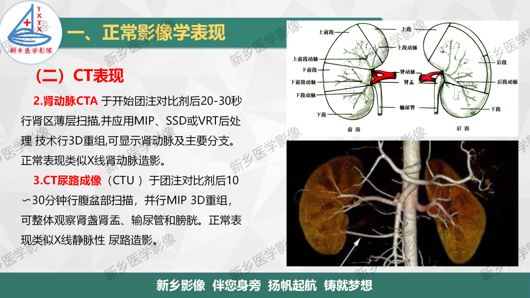 影像PPT - 【PPT】泌尿生殖系统解剖及基本病变影像表现-19