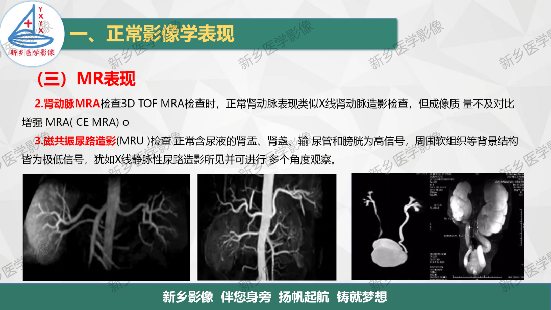影像PPT - 【PPT】泌尿生殖系统解剖及基本病变影像表现-23