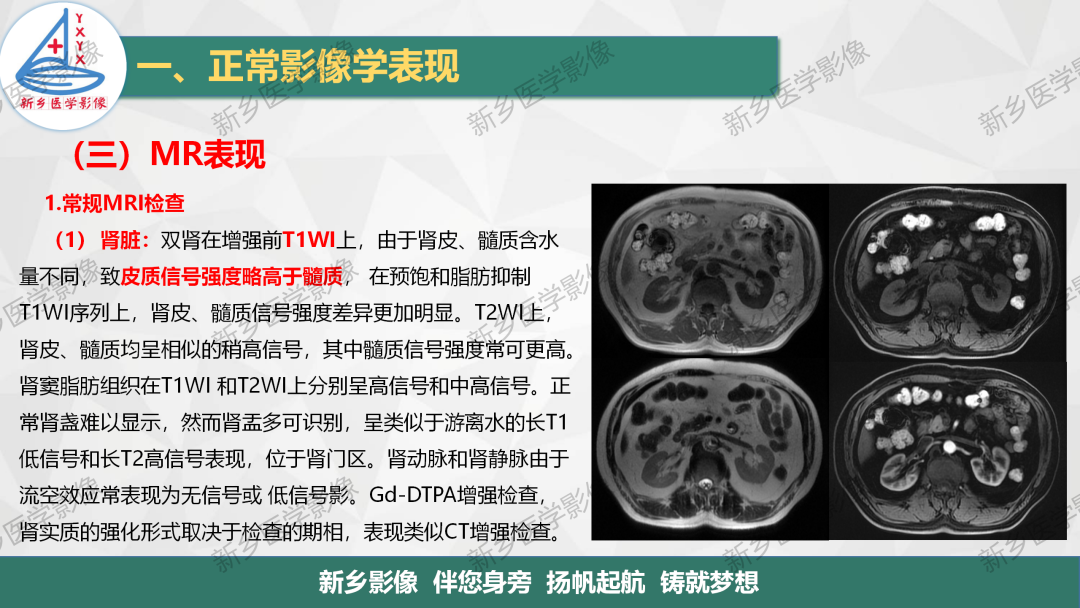 影像PPT - 【PPT】泌尿生殖系统解剖及基本病变影像表现-20