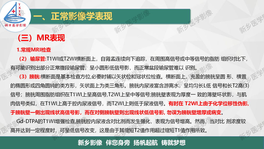 影像PPT - 【PPT】泌尿生殖系统解剖及基本病变影像表现-21