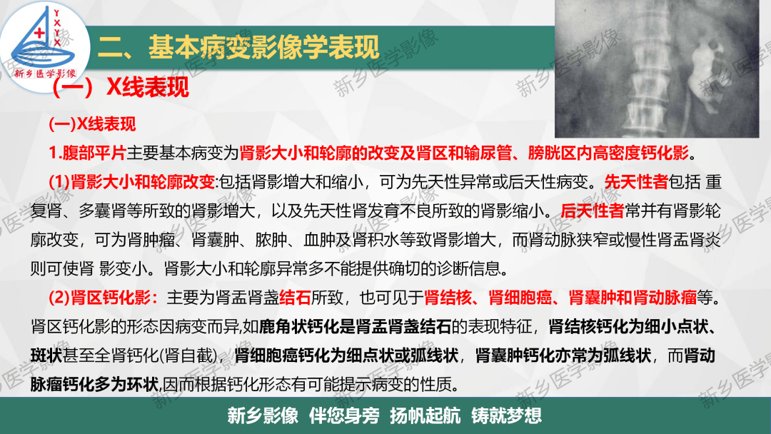 影像PPT - 【PPT】泌尿生殖系统解剖及基本病变影像表现-24