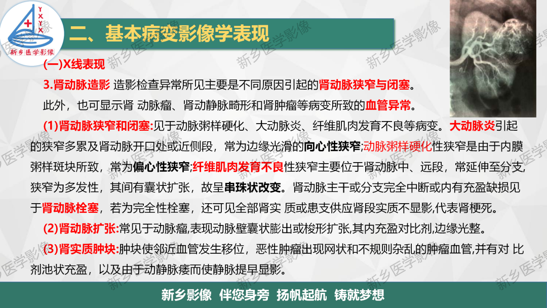 影像PPT - 【PPT】泌尿生殖系统解剖及基本病变影像表现-29