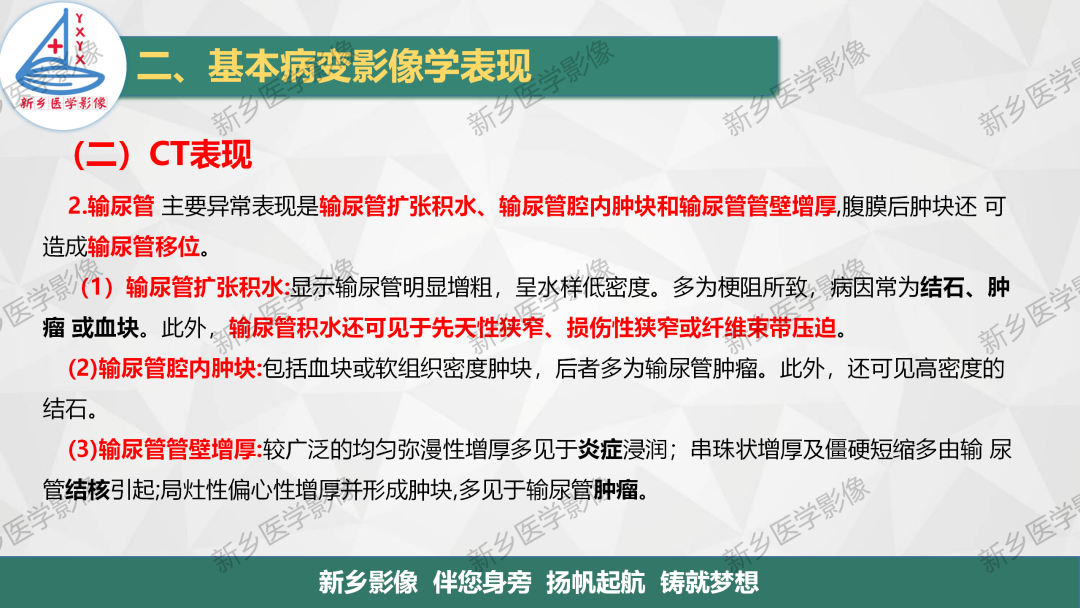 影像PPT - 【PPT】泌尿生殖系统解剖及基本病变影像表现-32