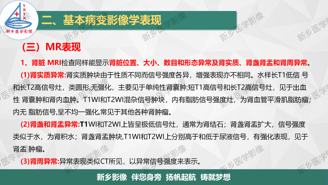 影像PPT - 【PPT】泌尿生殖系统解剖及基本病变影像表现-34