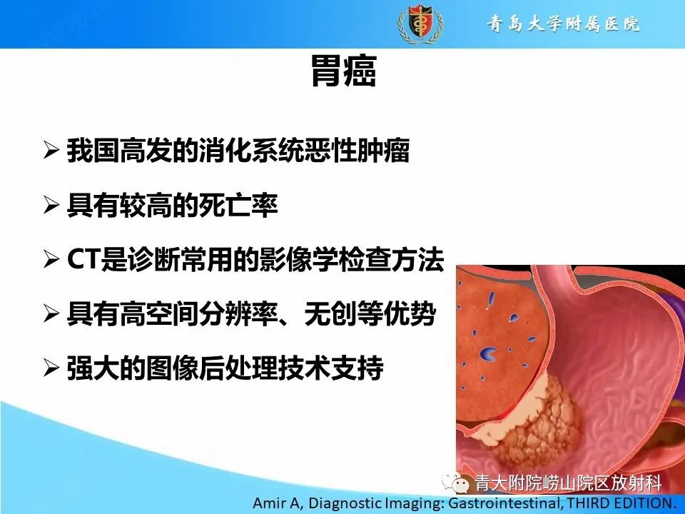 影像PPT - 【PPT】CT对胃癌诊断和临床应用价值-3