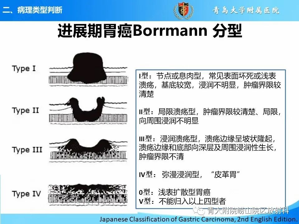 影像PPT - 【PPT】CT对胃癌诊断和临床应用价值-13