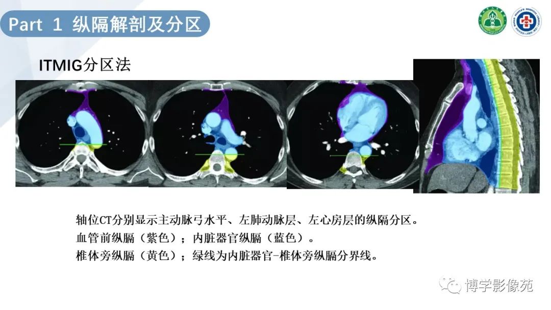 影像PPT - 【PPT】纵隔疾病-5