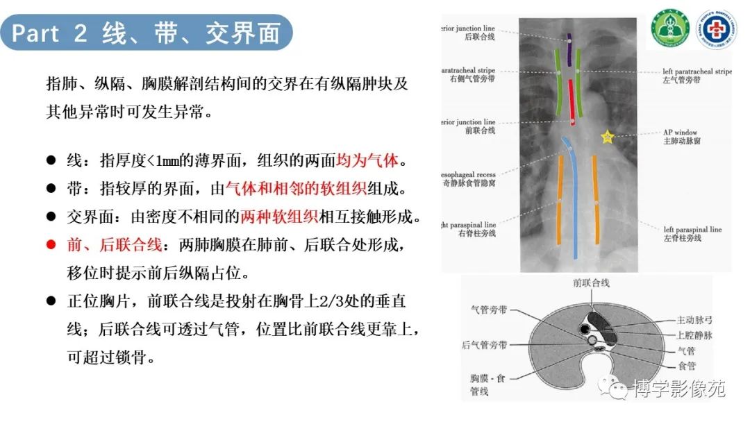 影像PPT - 【PPT】纵隔疾病-6