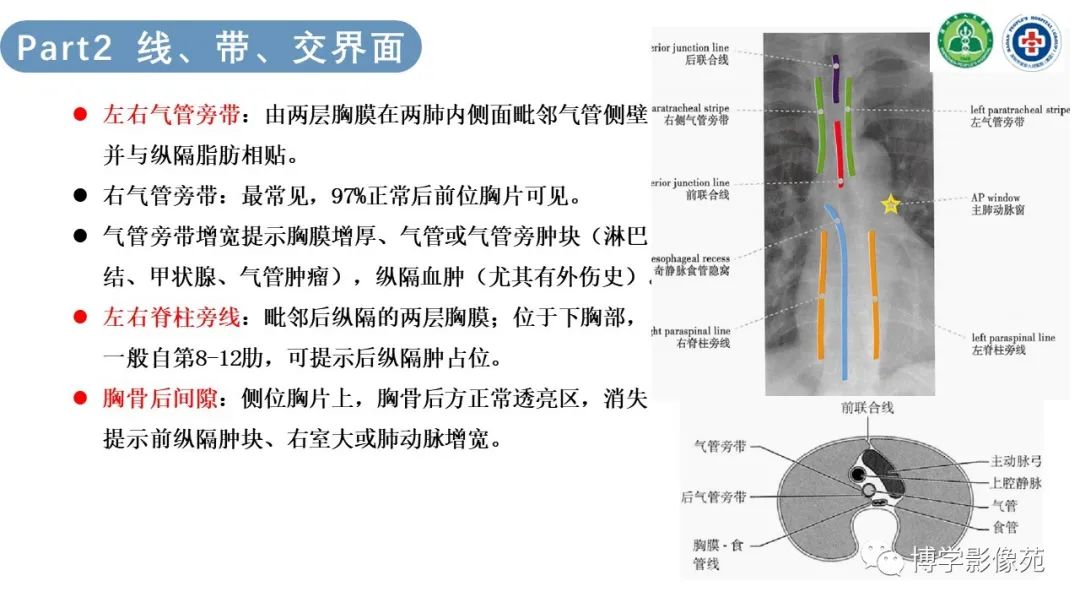 影像PPT - 【PPT】纵隔疾病-7