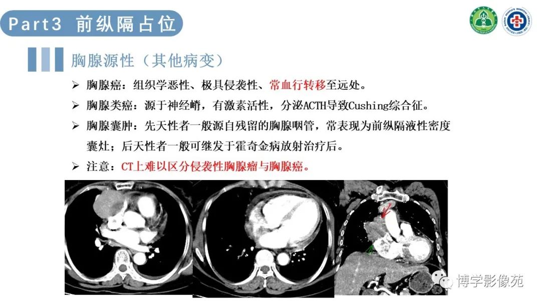 影像PPT - 【PPT】纵隔疾病-12