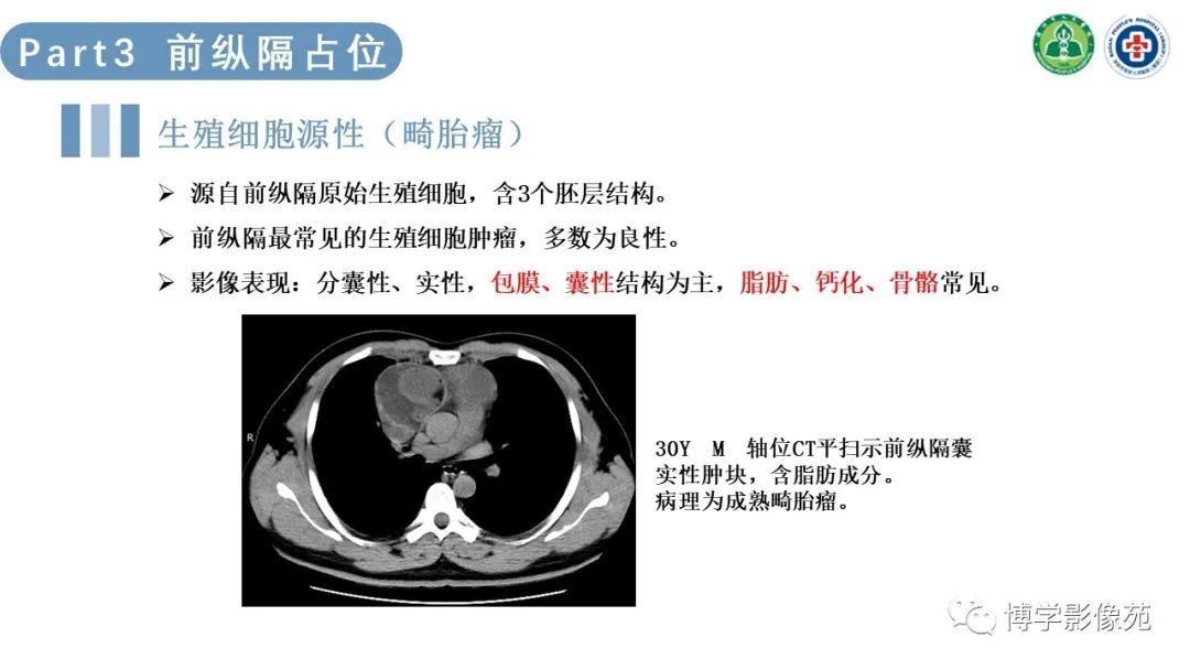影像PPT - 【PPT】纵隔疾病-13