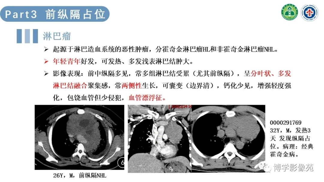 影像PPT - 【PPT】纵隔疾病-16